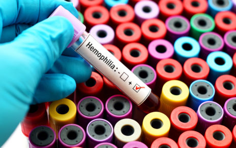 Ok. 3 tys. osób w Polsce choruje na hemofilię
