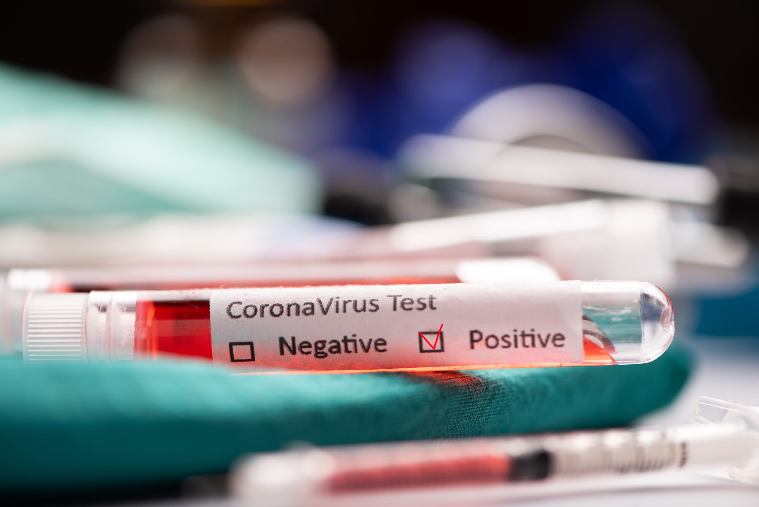 Dlaczego część testów na obecność koronawirusa jest fałszywie pozytywna?