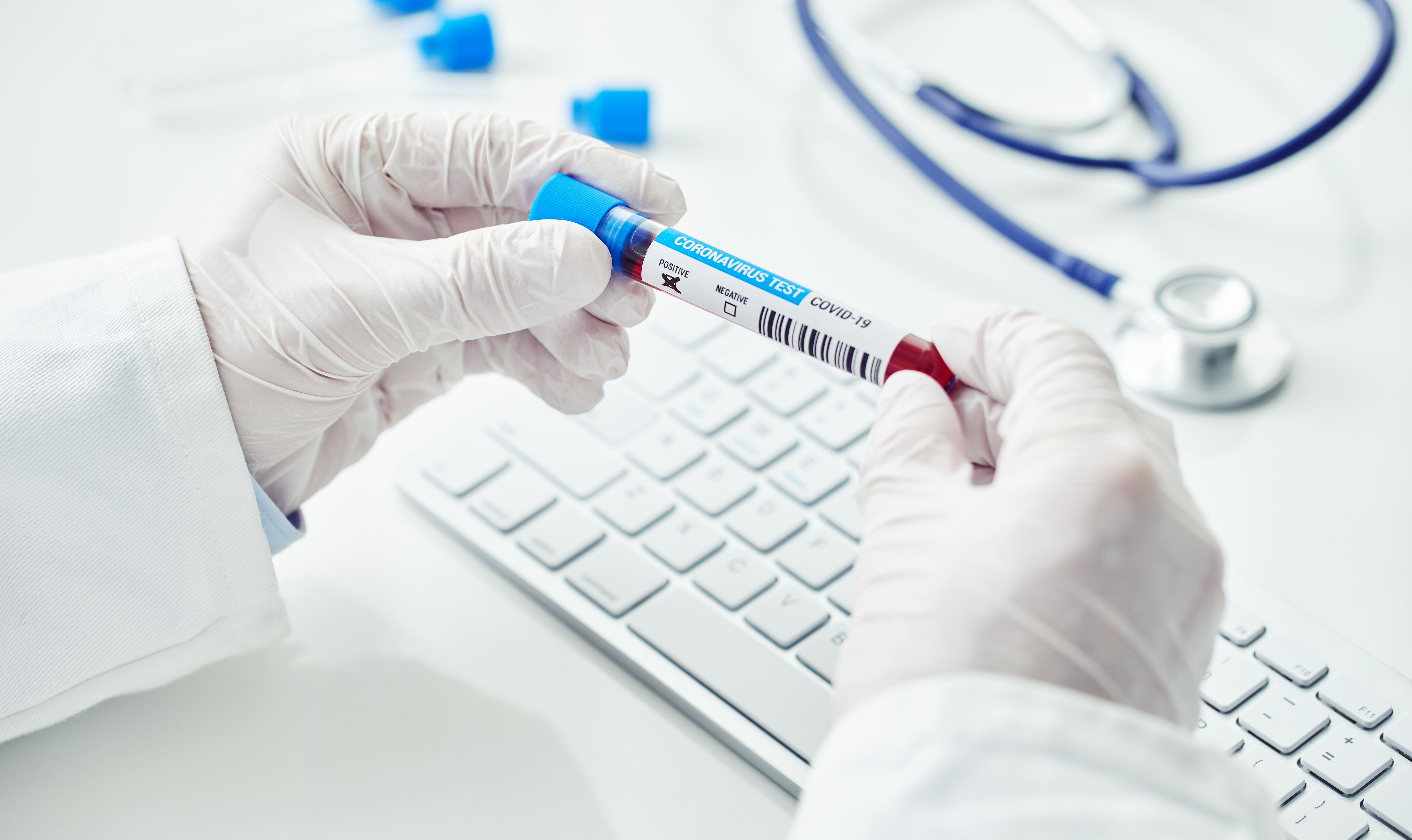 Uznanie testów antygenowych zwiększy liczbę notowanych zakażeń
